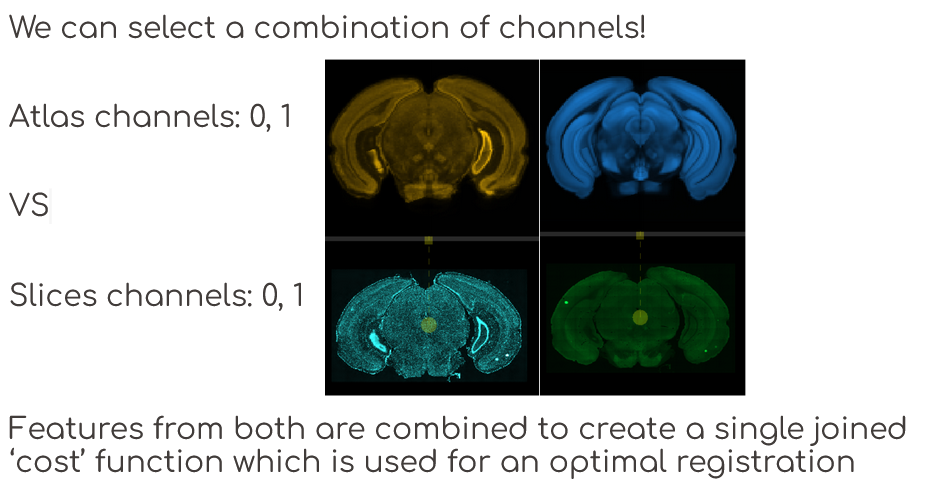 Multi Channels