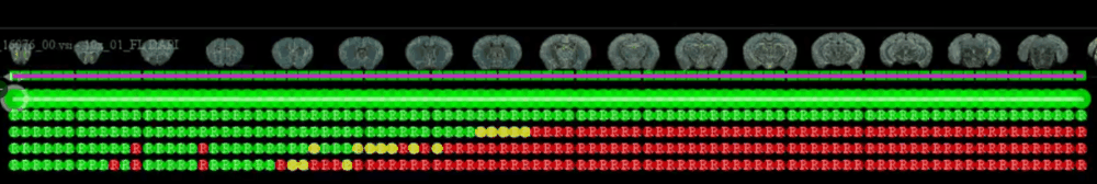 Multi slice registration sequence