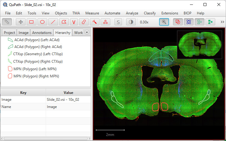 QuPath remove objects